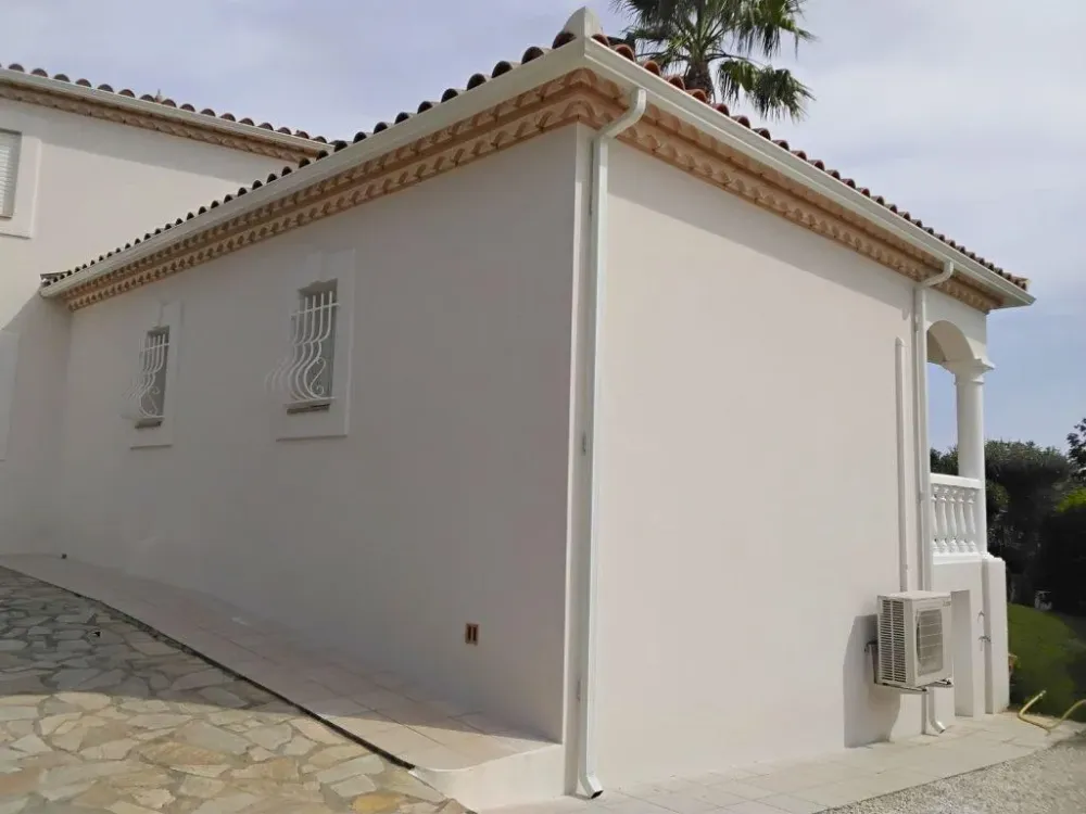 gouttières sur mesure (4)webp